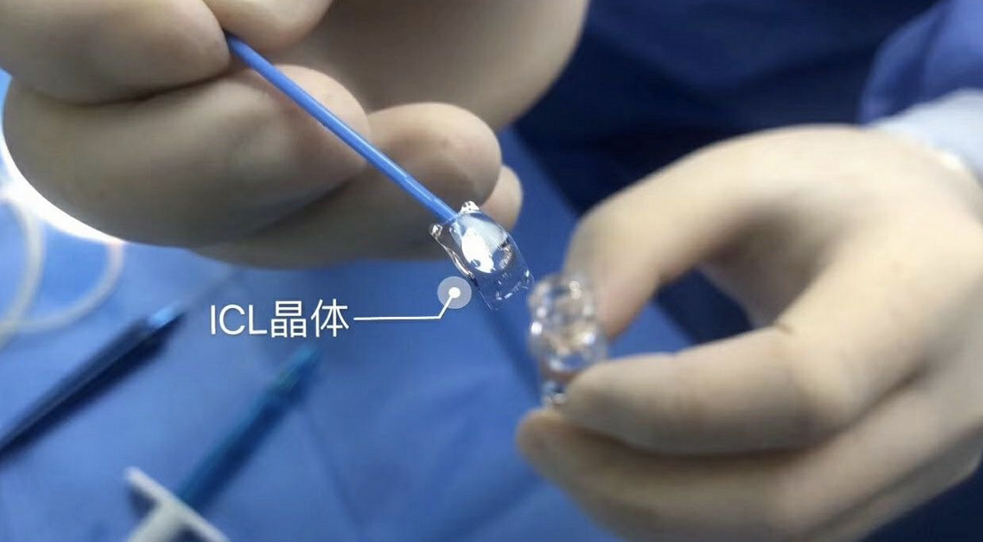 高度近視摘鏡ICL晶體植入術